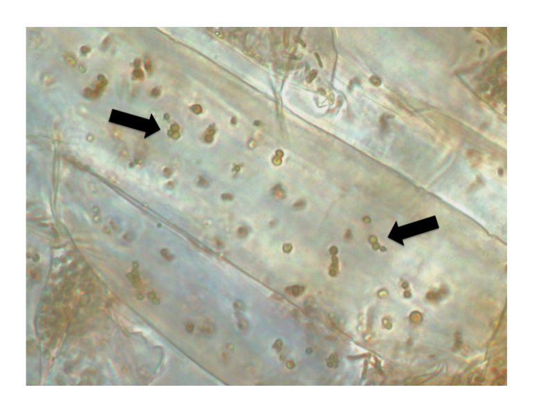 The arrows here point to bacterial microbes inside the root cells in seedlings of Phragmites. Those bacteria could help find a way to control the unwanted reed. Image: Great Lakes Phragmites Collaborative