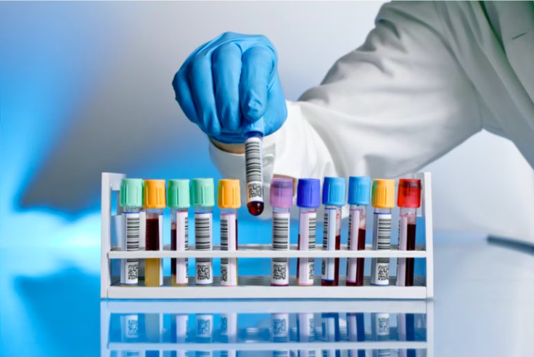 Vials used for blood testing being handled by a lab person with gloves on